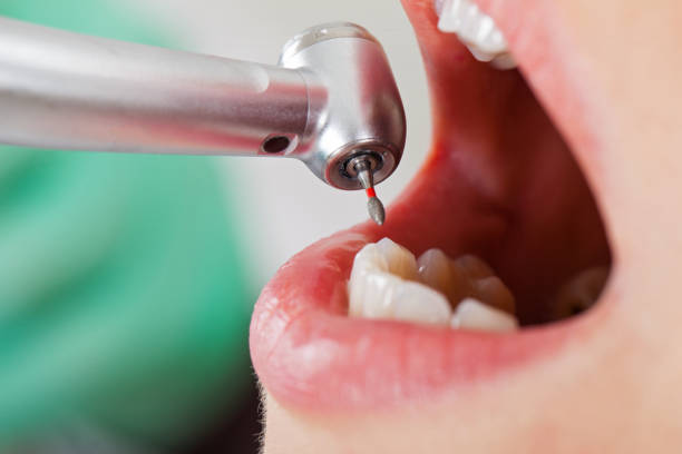 Best Dentist for Dental Trauma  in Greensburg, LA